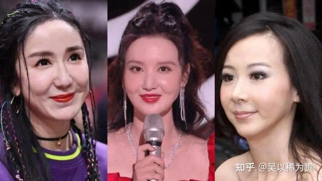 如何延长轮廓固定维持时间玻尿酸少女针童颜针天使针全系对比全国各地