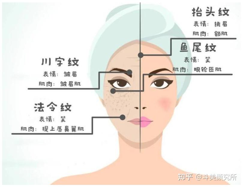 面部颜值“纹”题 | 静态纹和动态纹傻傻分不清楚？这篇文章帮你轻松搞定！ - 知乎