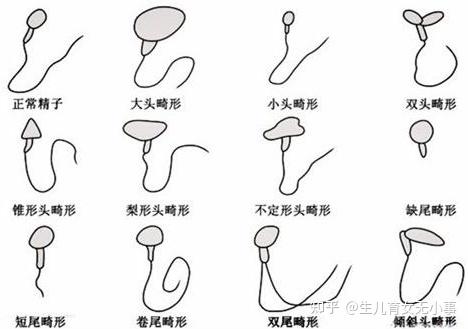 v2-83e99def95a3cf57acfb22341d5987cd_r.jpg