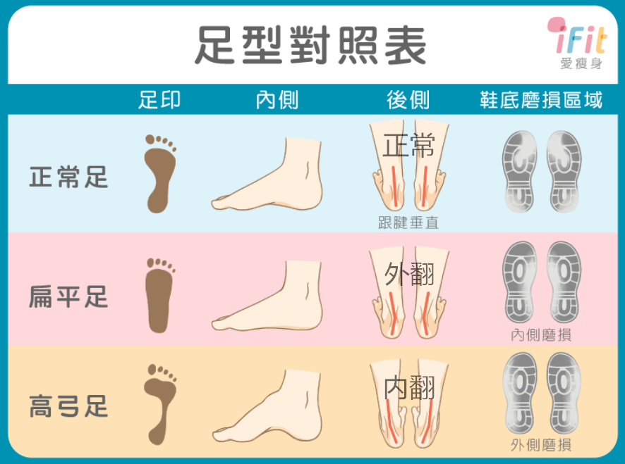 脚型分为高足弓