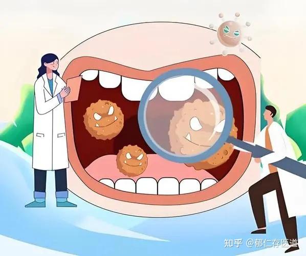别把癌症当成了上火,出现7个症状,可能是口咽癌的预警 - 知乎