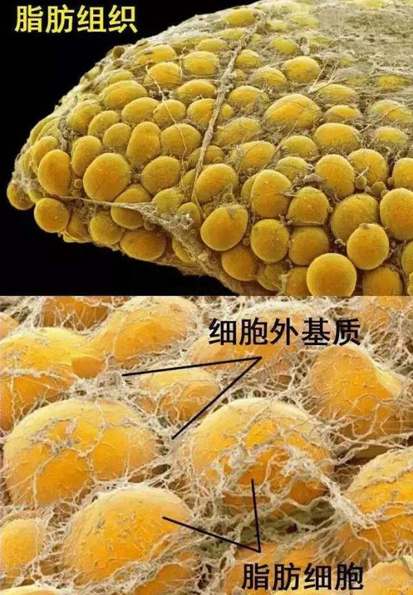 ECM/SVF-GEL：自体脂肪移植进入再生修复的2.0时代 - 知乎