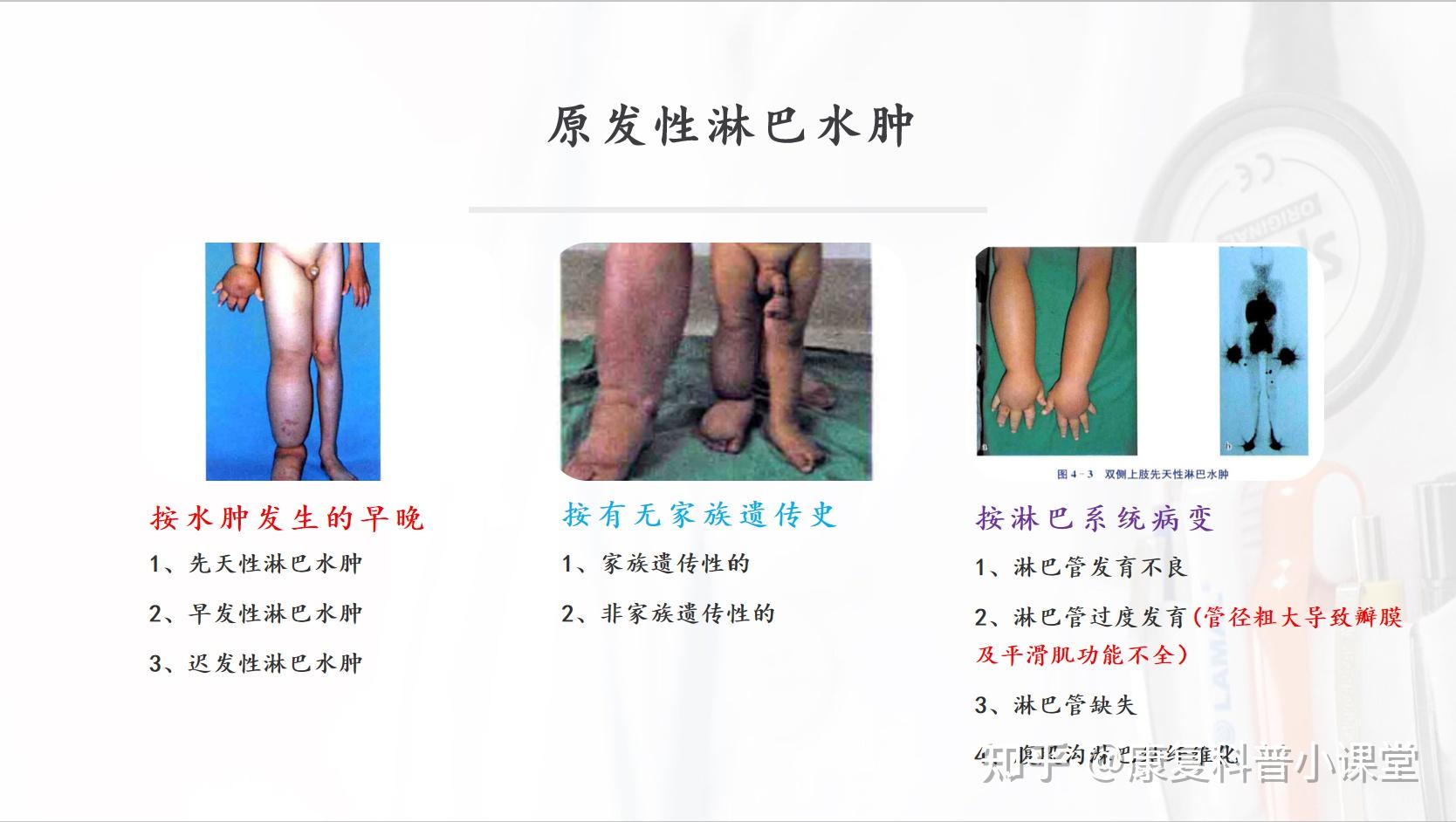 案例5:胫前粘液性水肿如何治疗？附7例重症典型患者治疗照片对照_下肢淋巴水肿_下肢淋巴水肿介绍 - 好大夫在线
