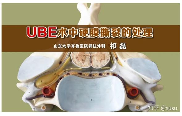 ube术中硬膜撕裂的处理山东大学齐鲁医院脊柱外科祁磊
