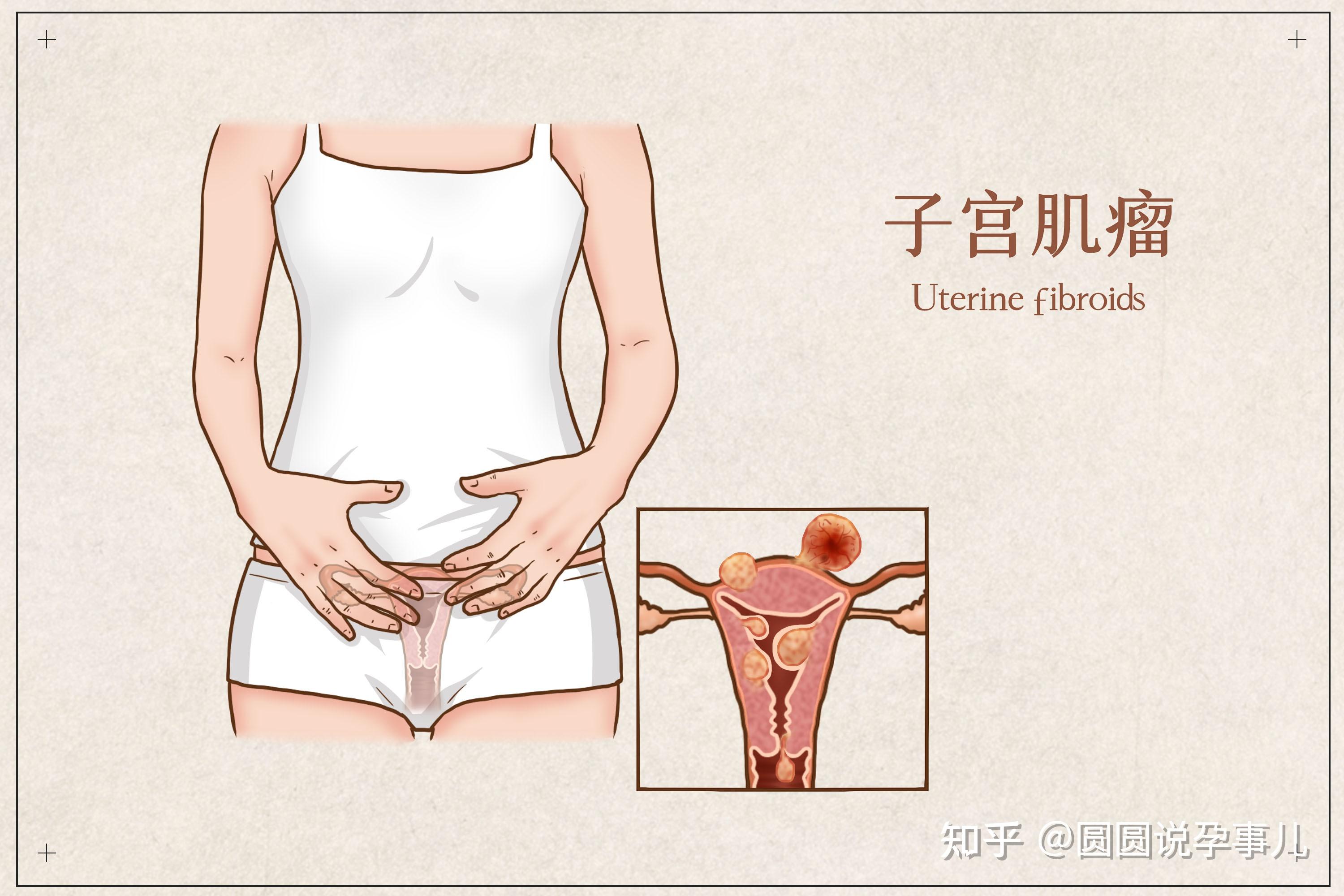 女性宫颈萎缩的图片图片