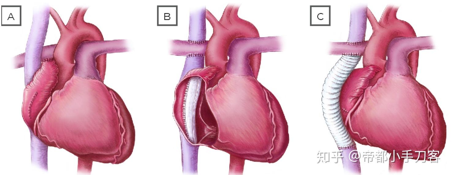 这对被囚禁了20年的母女让我看到了心魔
