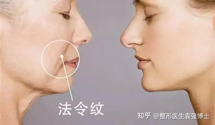 为什么你的法令纹总是去不掉,看看你是不是踩了这些坑 - 知乎