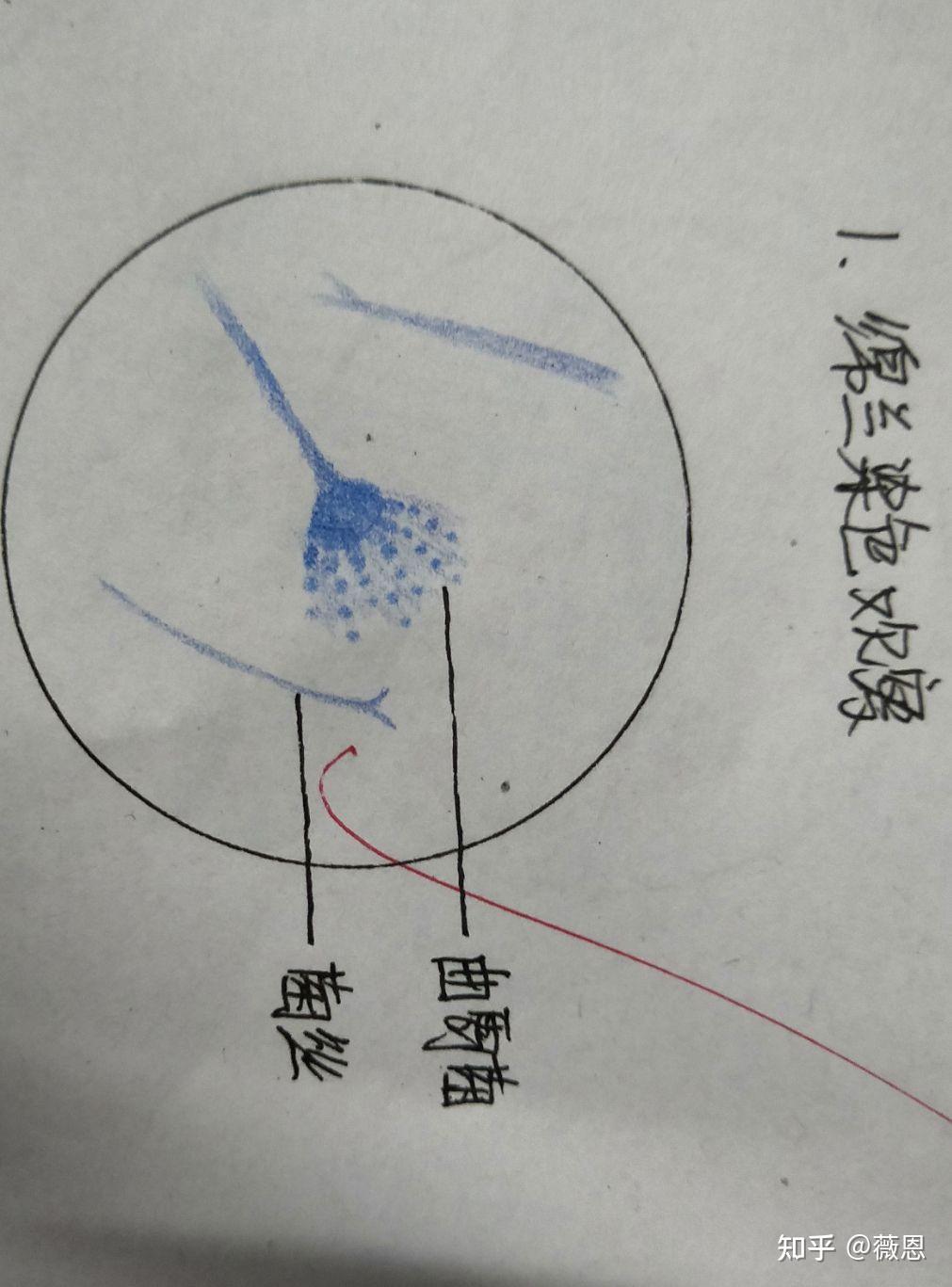 产气荚膜梭菌手绘图片