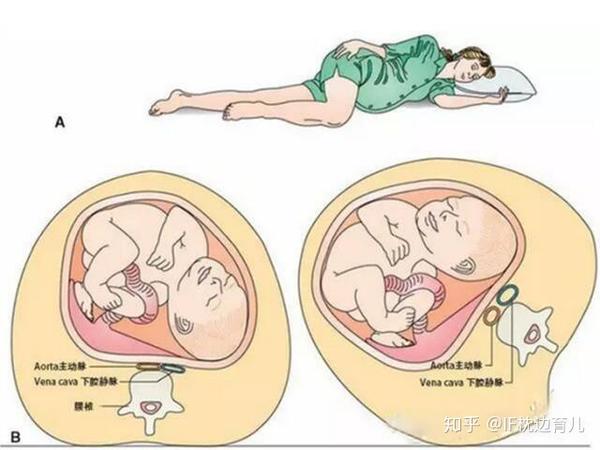 孕早期睡觉姿势图片