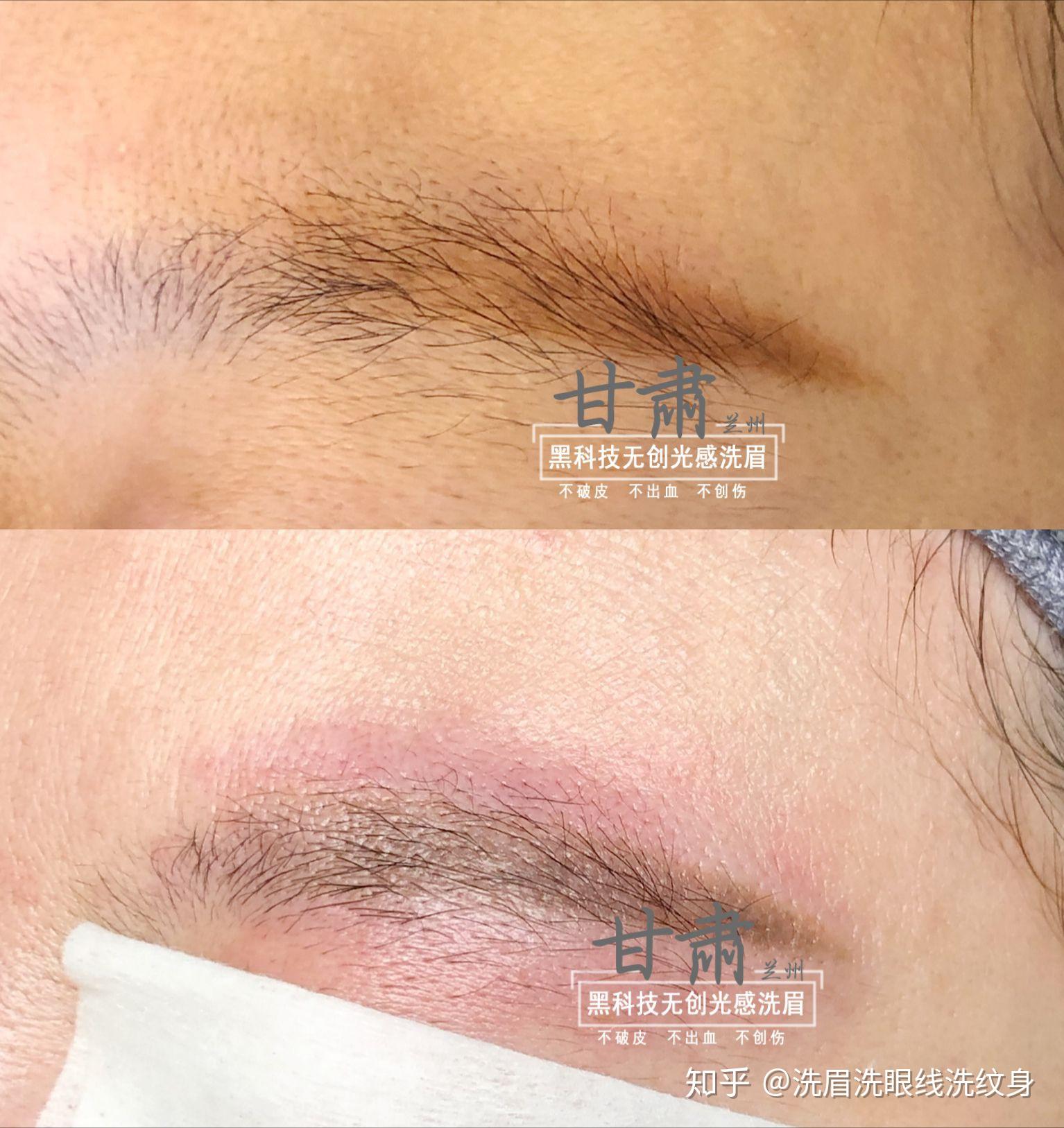 褪色了怎么办,过时了怎么办无创洗眉毛洗眼线洗纹身洗眉洗眼线洗纹身