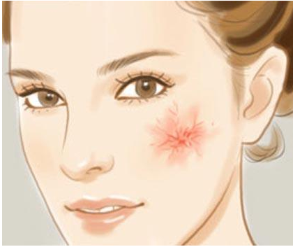 婴幼儿鲜红斑痣的发展过程