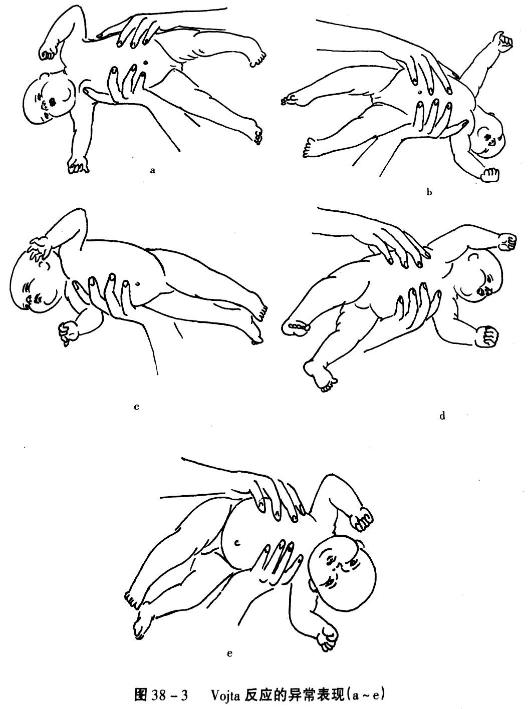 诱导患儿产生翻身和匍匐爬行两种反射性运动的方法