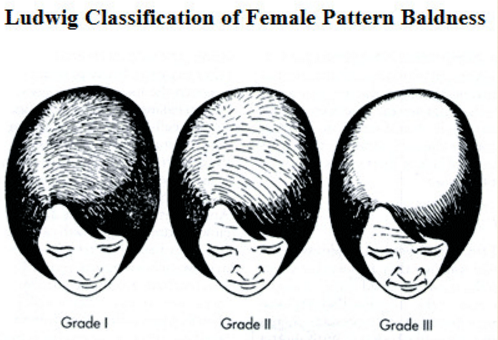 什么叫做无毛症 v2-85d47eaca42e565bbb806907fad5b461_r.jpg