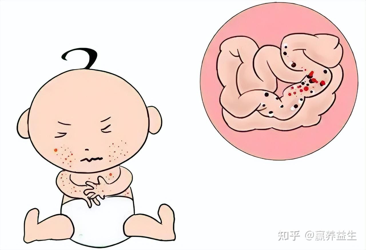 婴儿脖子疱疹图片,婴儿疱疹图片新生儿 - 伤感说说吧