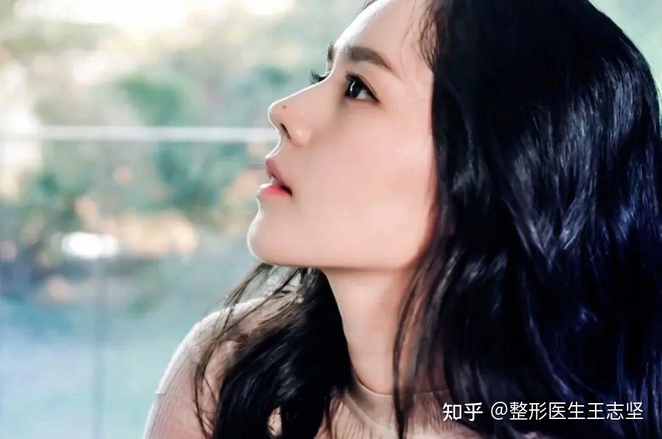 小巧精致的韩佳人鼻子带微驼峰的刘亦菲款鼻子7.鼻翼缘矫正6.