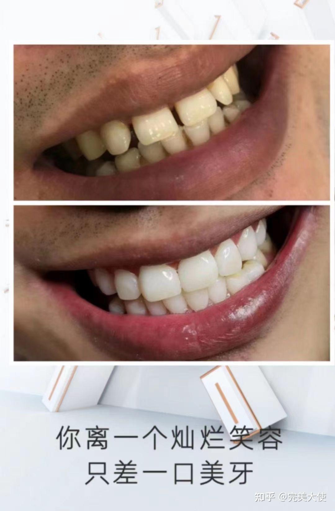 完美大师打造国内第1口腔连锁品牌