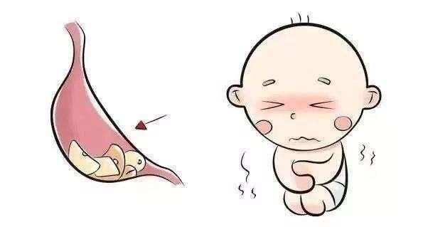 什么是疳积小孩子怎么预防疳积