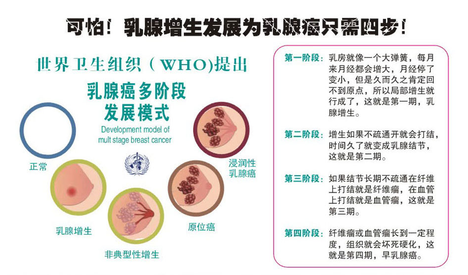 臭脾气让你惹上乳腺增生,小心增生的三大诱因,四个危害