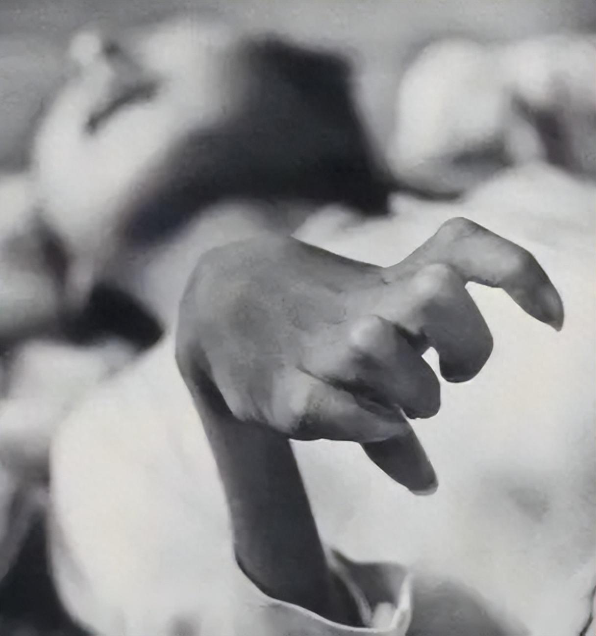 "但是病症持续几年后,患者全身各部位会发生神经痛,骨痛现象,行动困难