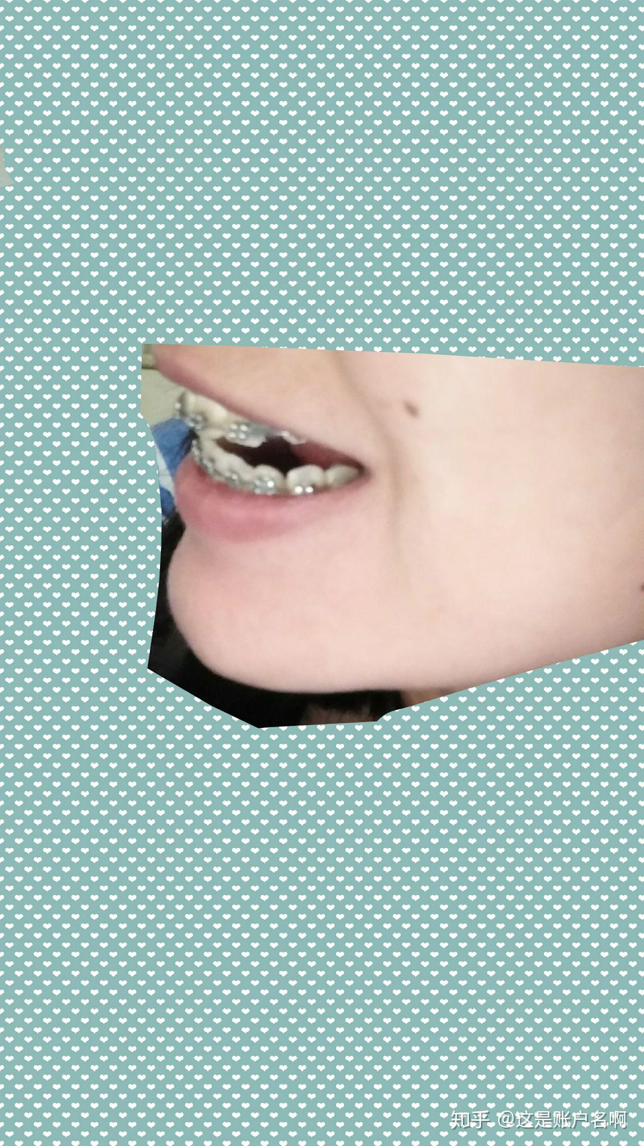 v2-86e4e97f497cc5f6cad6763dd83e0fb5_r.jpg