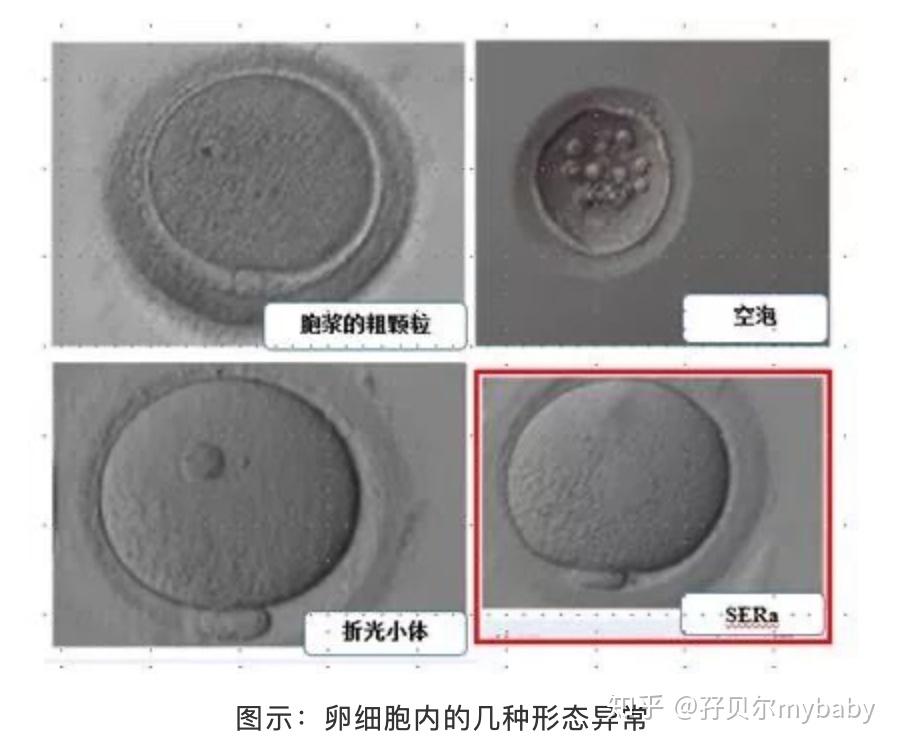 我的卵子是否完美? - 知乎