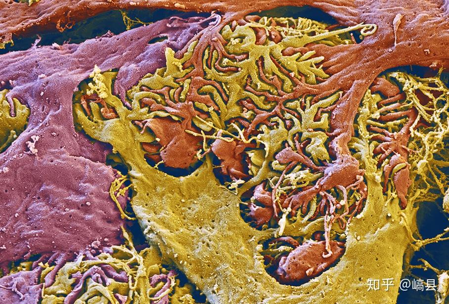 10. 肾小球(glomerulus of the kidney)