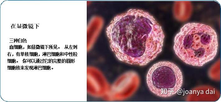 何为霍奇金淋巴瘤究竟好不好治