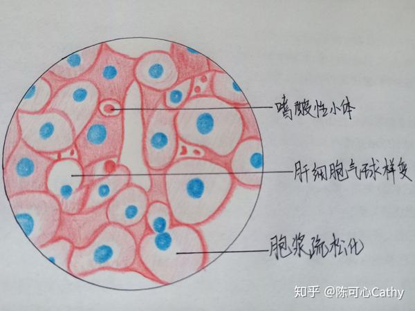 巨噬细胞手绘红蓝图图片