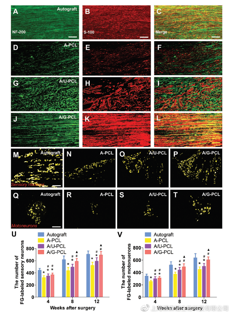 图4 免疫组化染色和荧光金逆行示踪图5 腓肠肌masson染色,坐骨功能