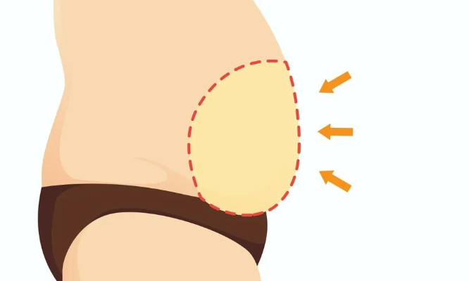 你要瘦瘦瘦瘦吗一次安排到位