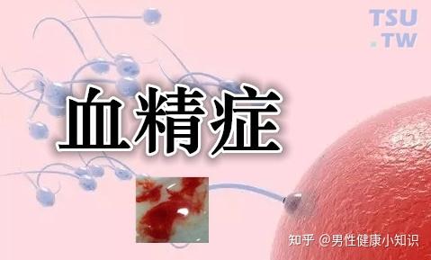 株洲九龙医院:精液带血别慌张,正确认识血精症! - 知乎