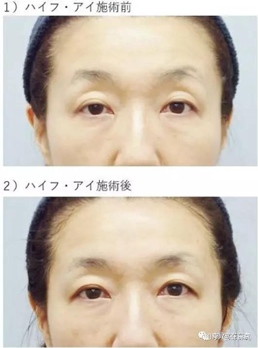 日本名医大起底 杉野宏子 美容外科 美容皮肤科 形成外科丨日本整容整形 知乎