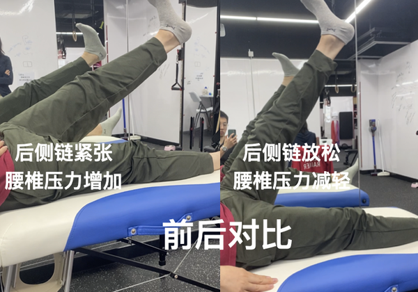 什么是运动康复? - 知乎