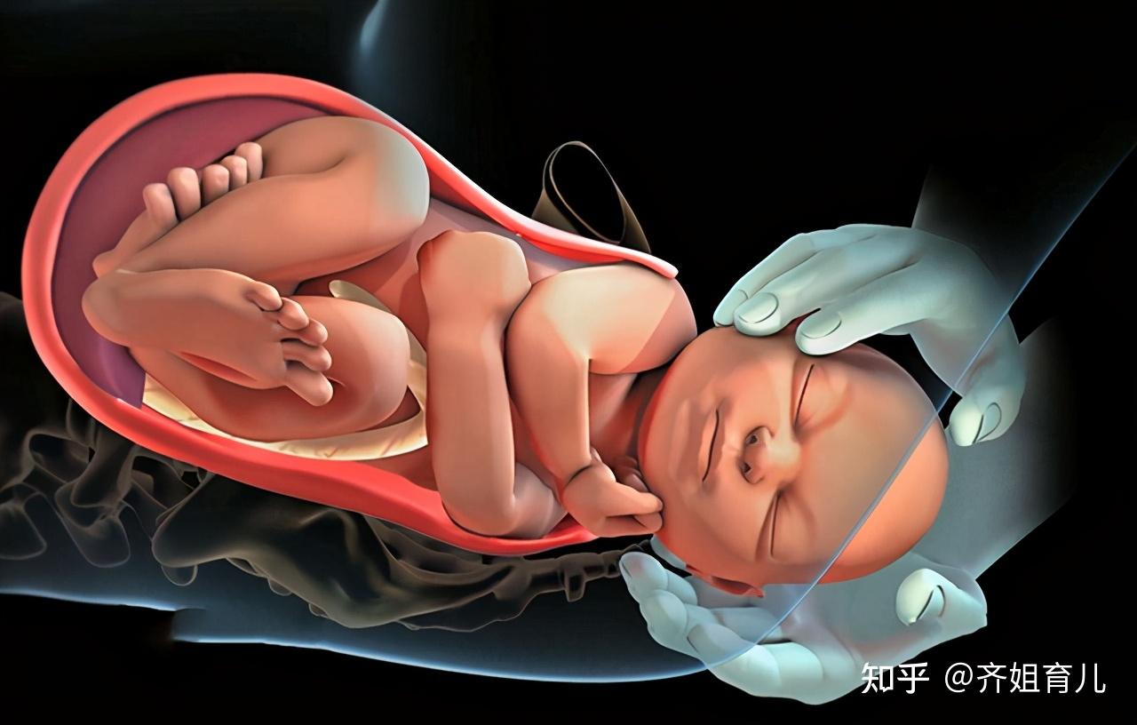 先破水生男先见红生女与胎儿性别无关两者区别是这些