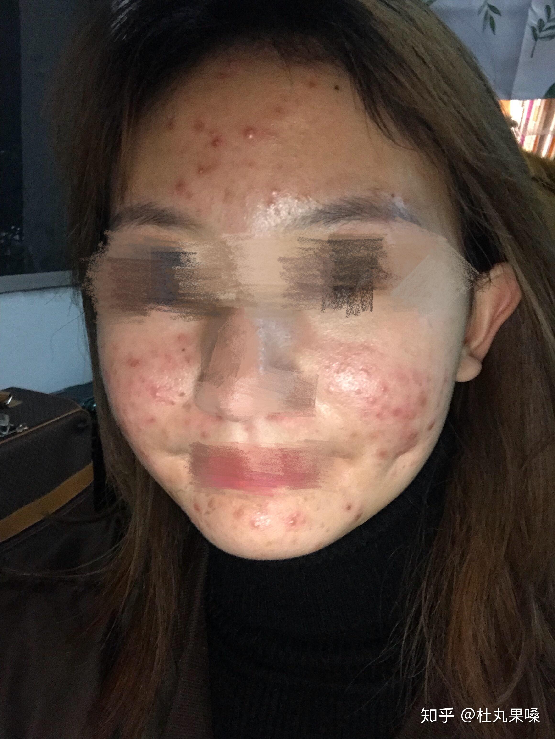 v2-88fb4779c3f83c81170562719600baf9_r.jpg