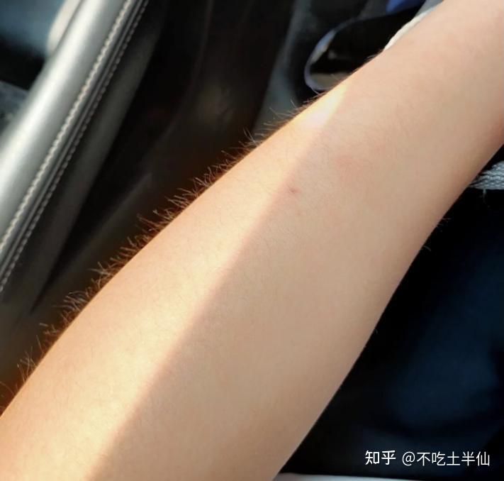 关于cm脱毛膏用了有鸡皮肤的信息 关于cm脱毛膏用了有鸡皮肤的信息