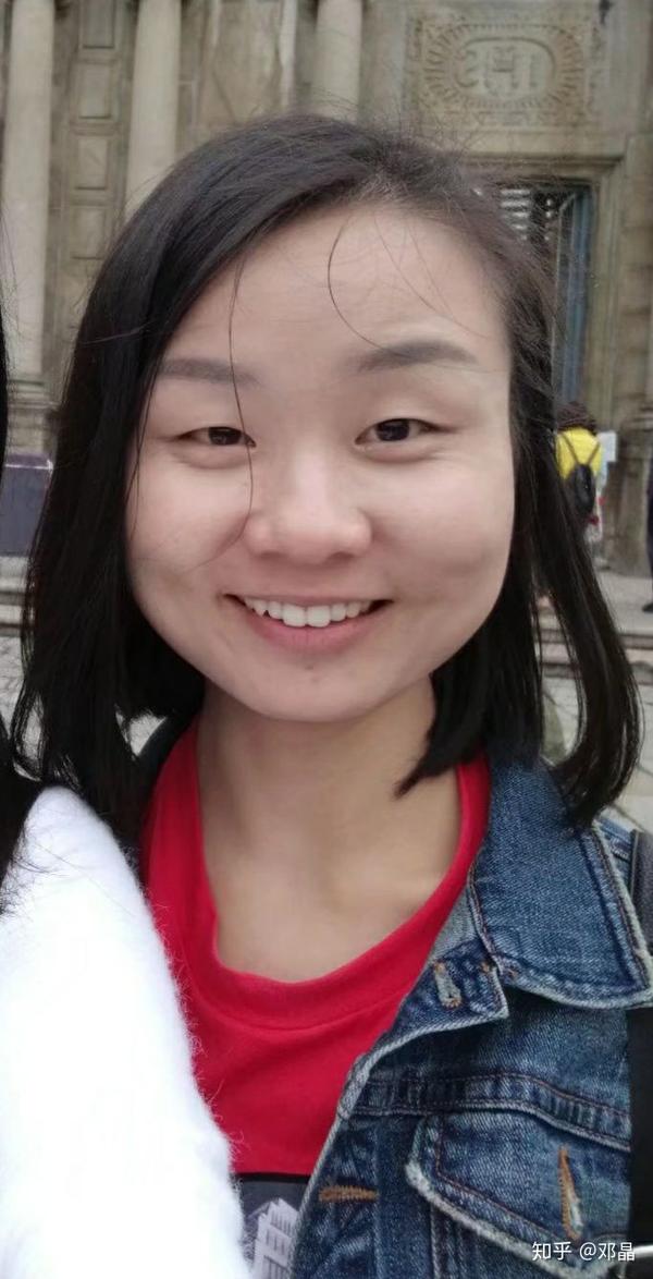 割个双眼皮真开心