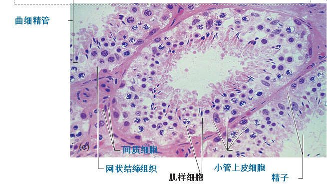 睾丸活检报告图片