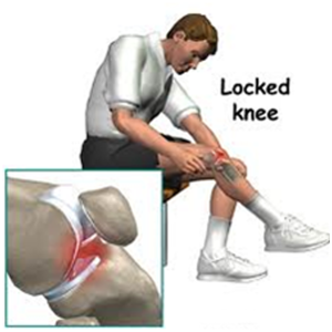 踢足球后膝盖疼右腿膑骨右下侧用手一按就疼,