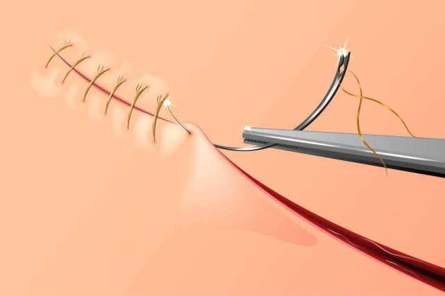 缝合线连接力测试仪yy1116-2020 测试仪原理是啥? - 知乎