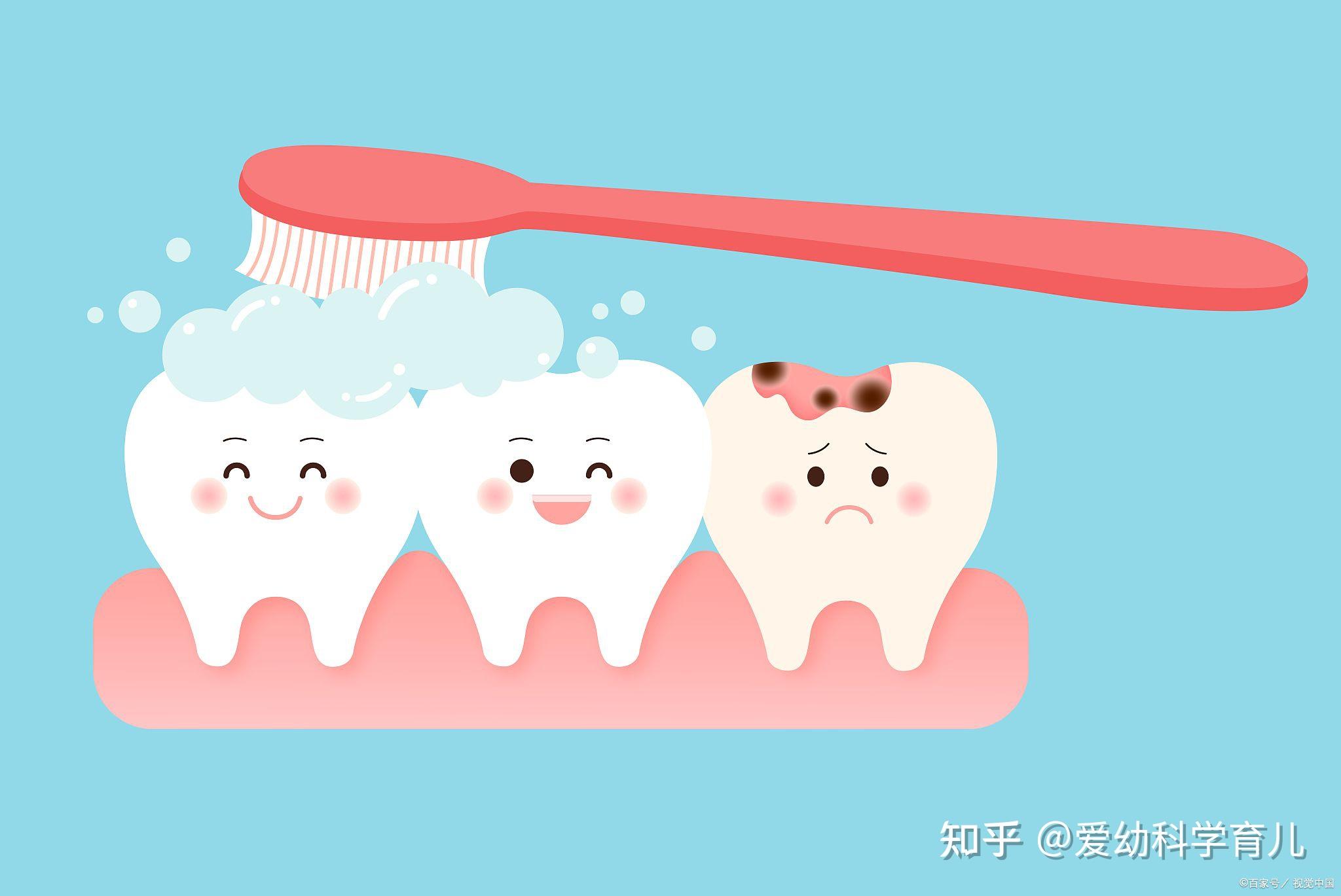 刷牙的重要性/牙菌斑染色剂自检/牙菌斑这种可恨的小玩意 - 知乎