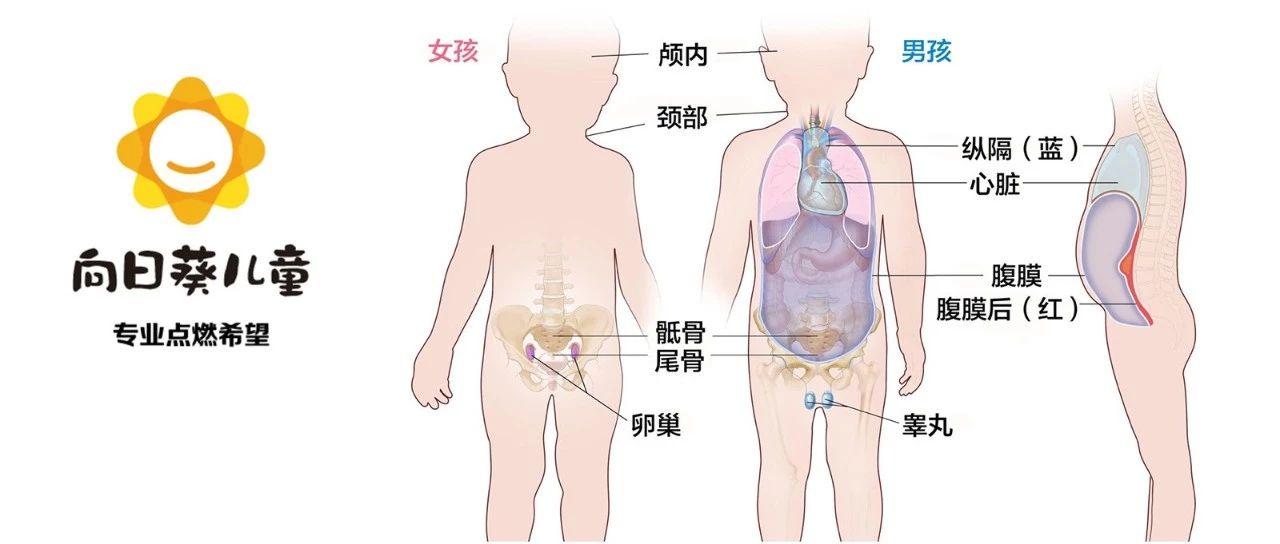 5年生存率可能低到40 成熟和未成熟畸胎瘤到底怎么治 知乎