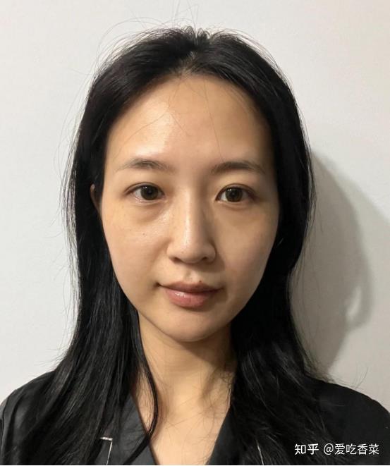 胶原蛋白肽真的能拯救老化皮肤吗?