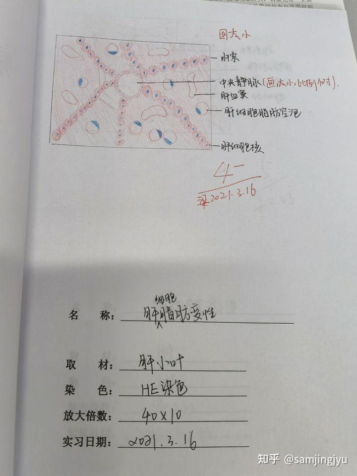 肺淤血实验报告手绘图图片