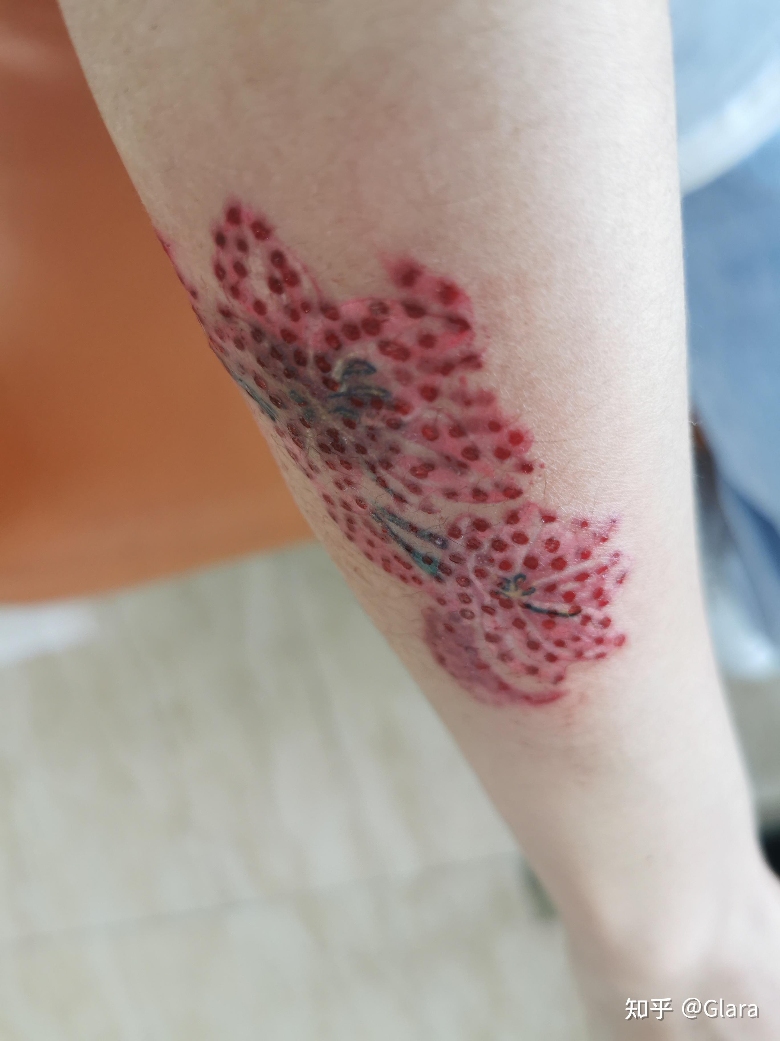 洗彩色纹身的艰辛历程