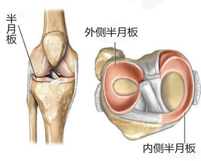 半月板損傷能自愈嗎?