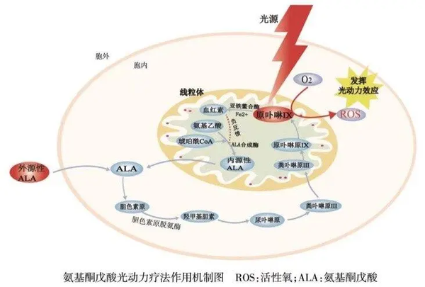 技术|光动力疗法(PDT) - 知乎