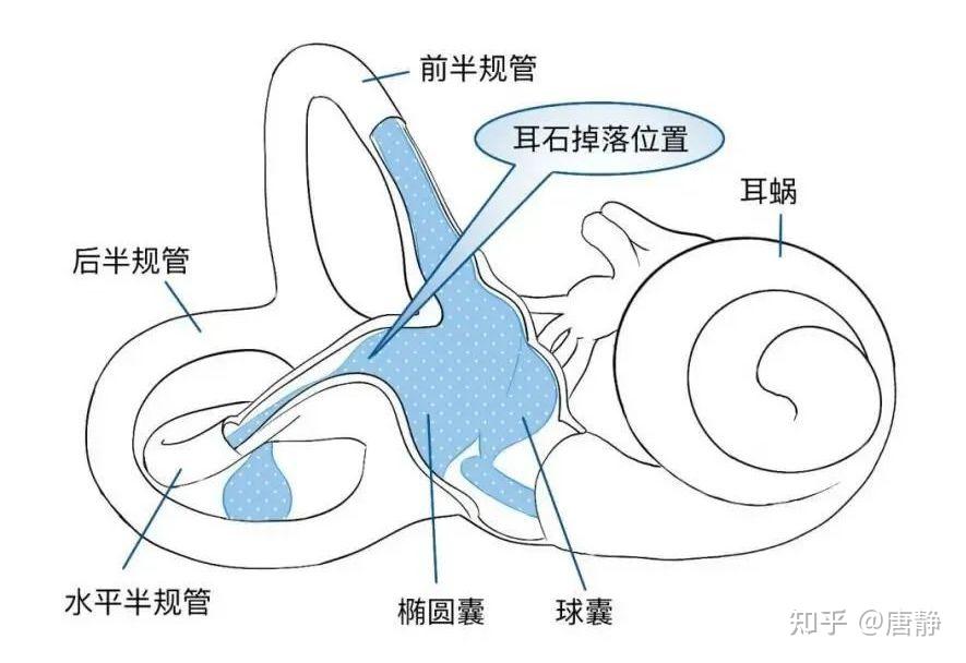 耳石症结构图图片