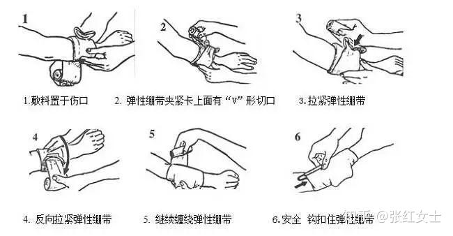 疤痕常识 学会这4招