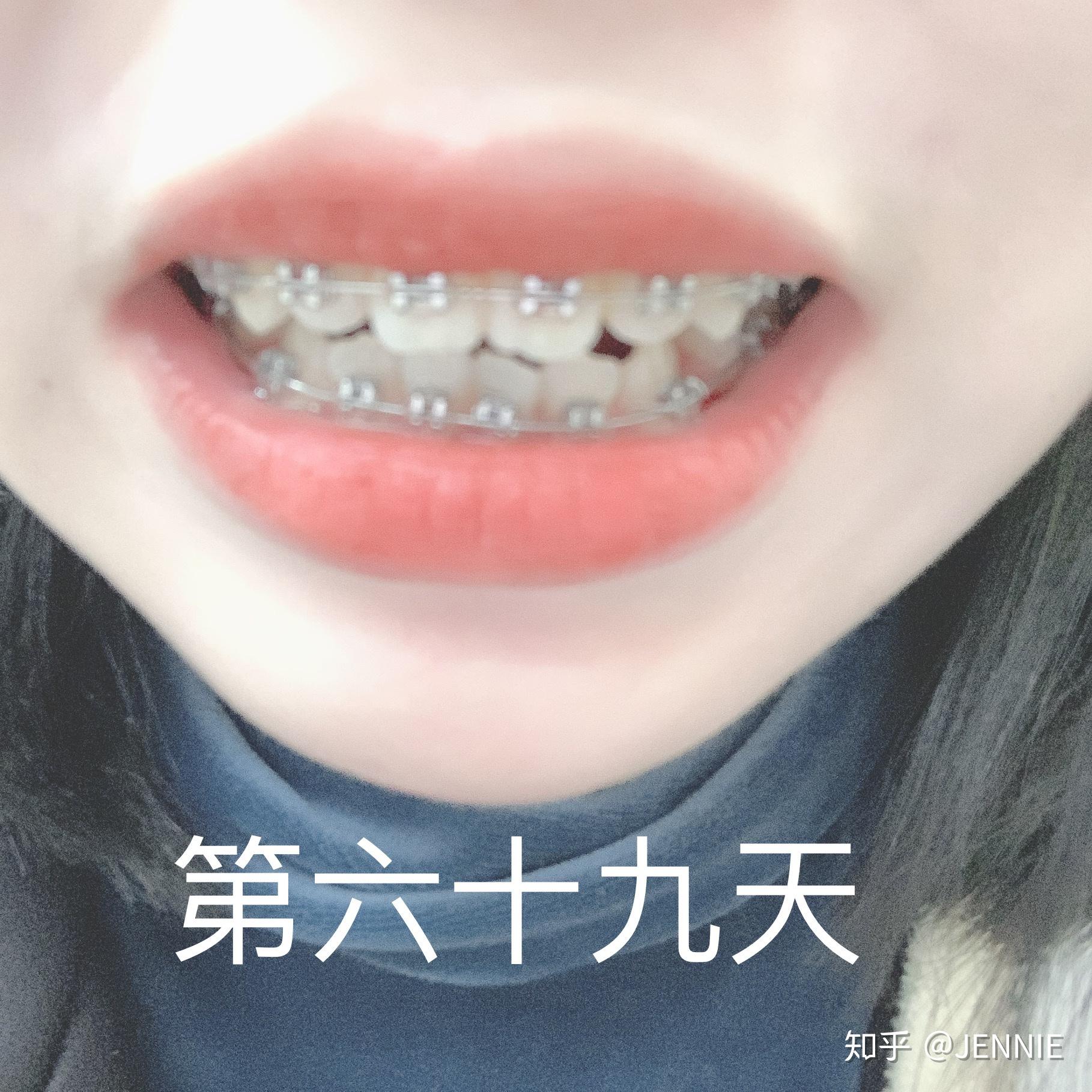 v2-8ab9d649f0fa11f028aef5677cfdcebd_r.jpg